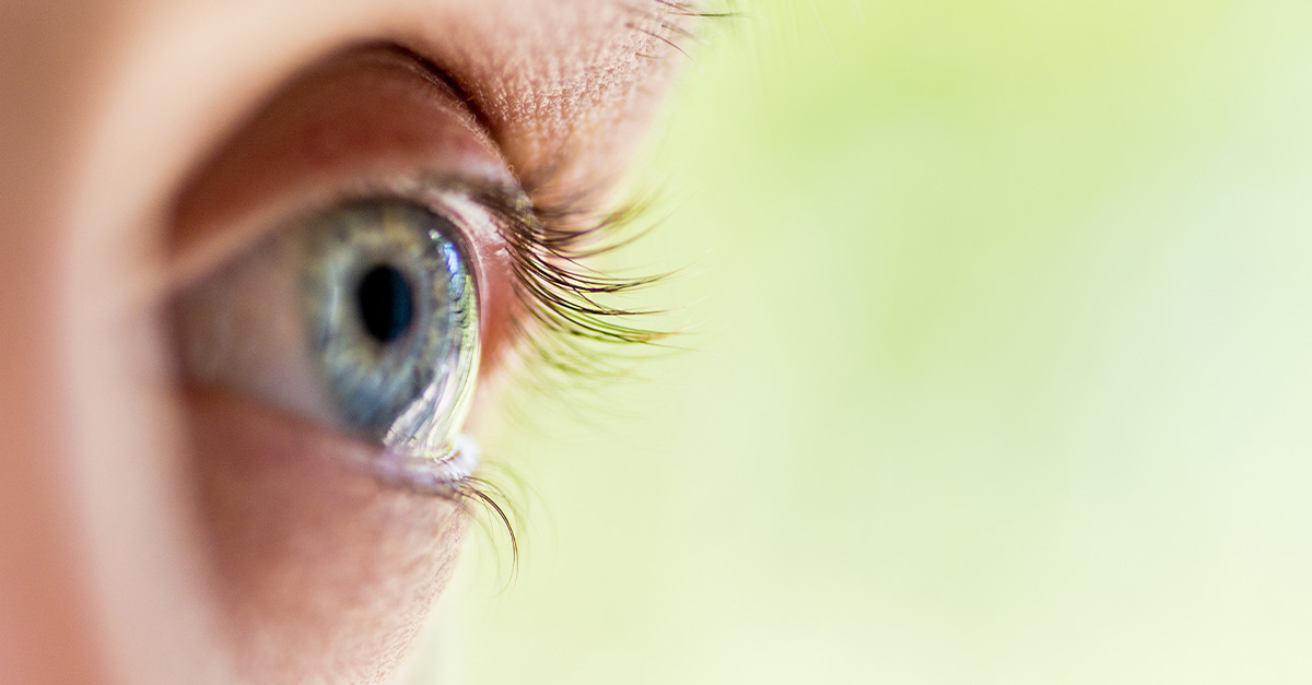 A close up of an eye after LASIK